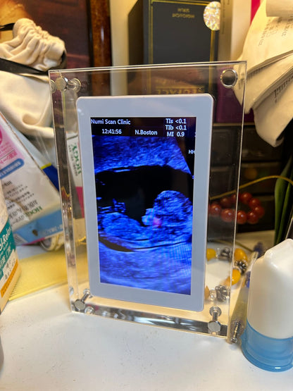 Pixora™ Dijital Çerçeve