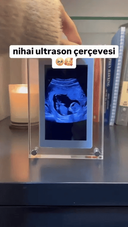 Pixora™ Dijital Çerçeve